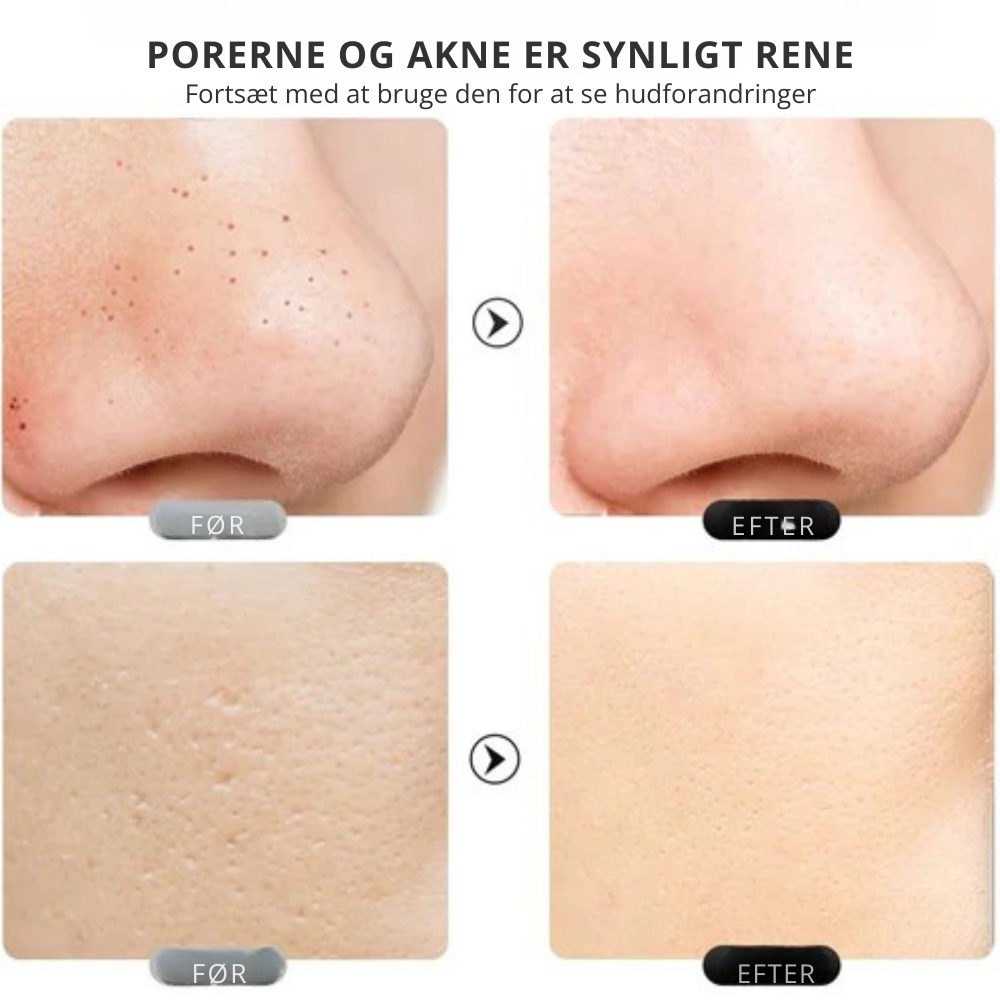 DermaPure | Ultralydsskrubber til huden | Vanero