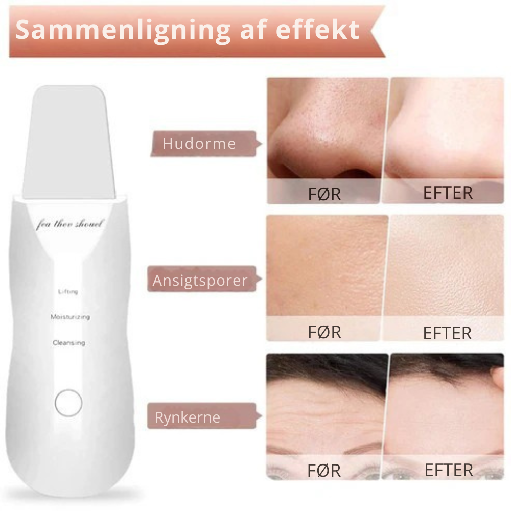 DermaPure | Ultralydsskrubber til huden | Vanero