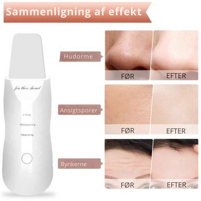DermaPure | Ultralydsskrubber til huden | Vanero