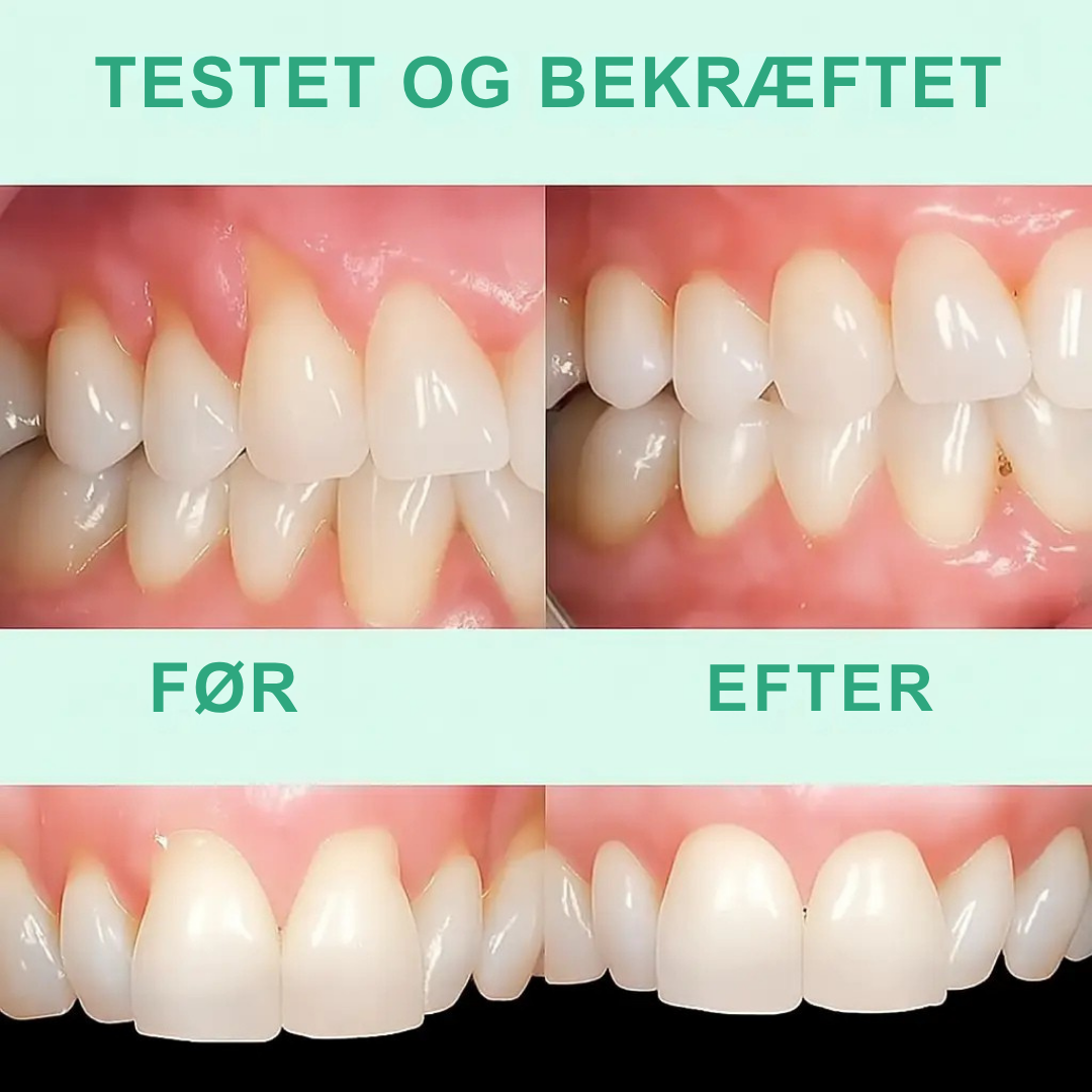 GumVital | Synlig bedring af tandkødet på 93%! | Vanero