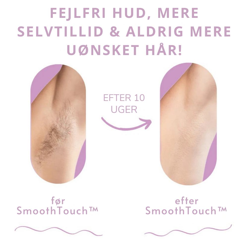 SmoothTouch I Den førende laserhårfjerning til hjemmet l Vanero