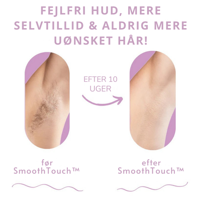 SmoothTouch I Den førende laserhårfjerning til hjemmet l Vanero