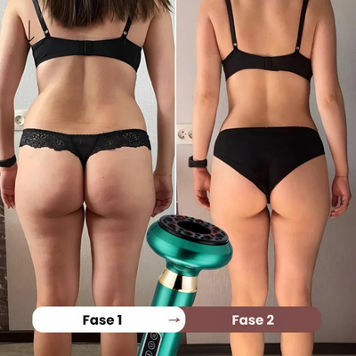 CelluSculpt | Oplev en synligt glattere og strammere hud l Vanero