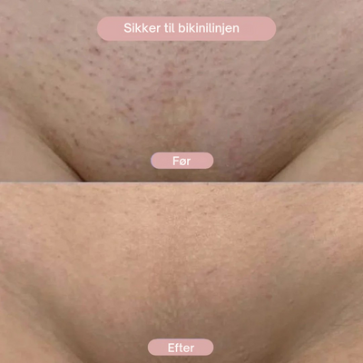 Silkglide | Din Hud Fortjener Kun Det Bedste | Vanero