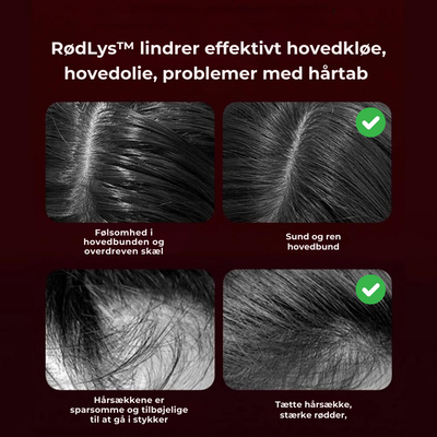 Hårbørste | Hovedmassage med spa-følelse | Vanero