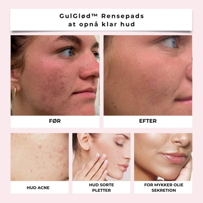 Revolutionerende Rensepads | Skin-Boost Formel Pakke med 30 | Vanero