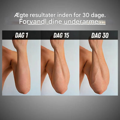 NovaFlex Trainer | Styrker Fingrene Og Lindrer Stress | Vanero