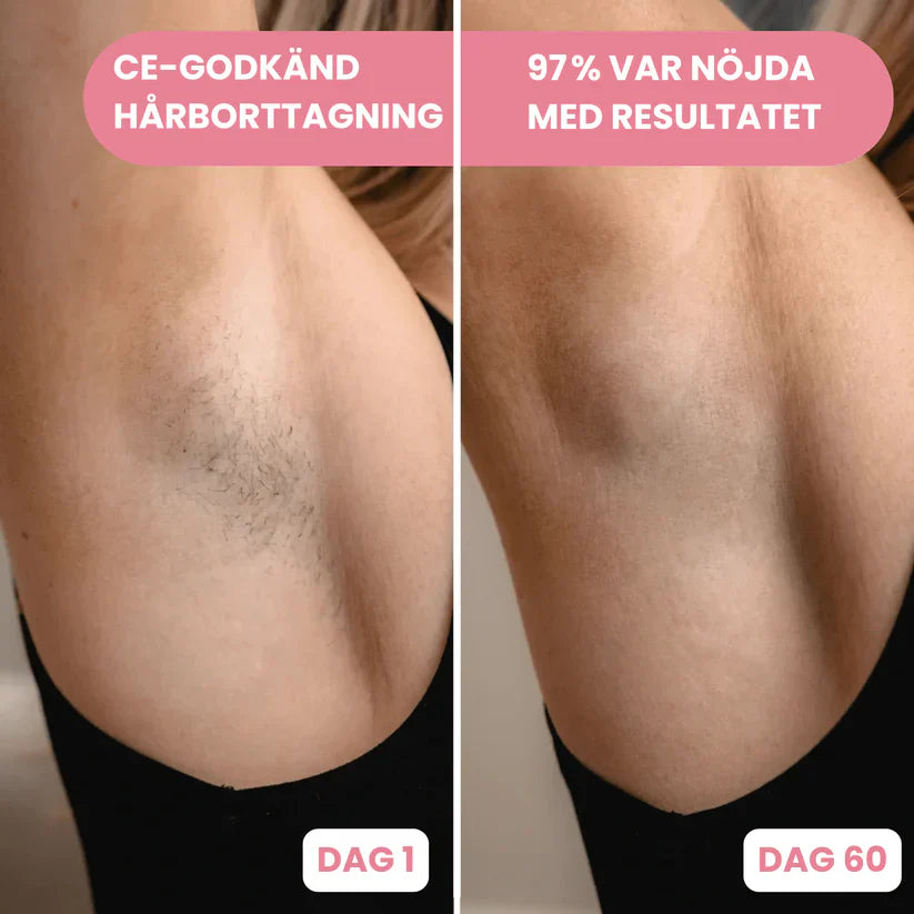 Lumina IPL | Avanceret IPL Til Hjemmebrug | Vanero