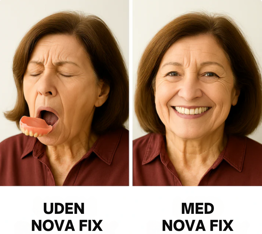 Fix | Få Dit Gebis Til At Sidde 100% Fast I Op Til Syv Dage | Vanero