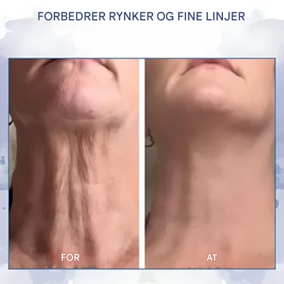 Luxe | Opstrammende og Antirynkecreme 100 ml | Vanero