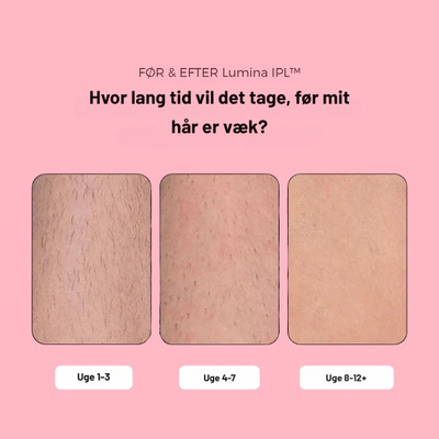 Lumina IPL | Avanceret IPL Til Hjemmebrug | Vanero