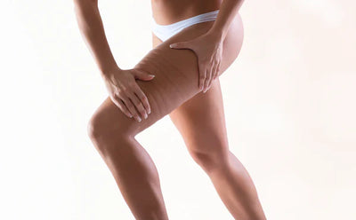 CelluSculpt | Oplev en synligt glattere og strammere hud l Vanero
